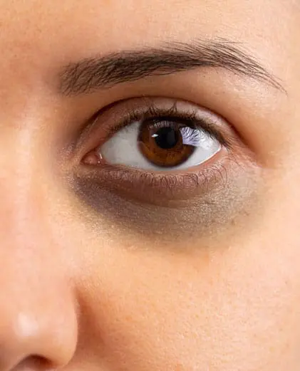 dr-grace-kelly-your-conditions-face-dark-circles-featured