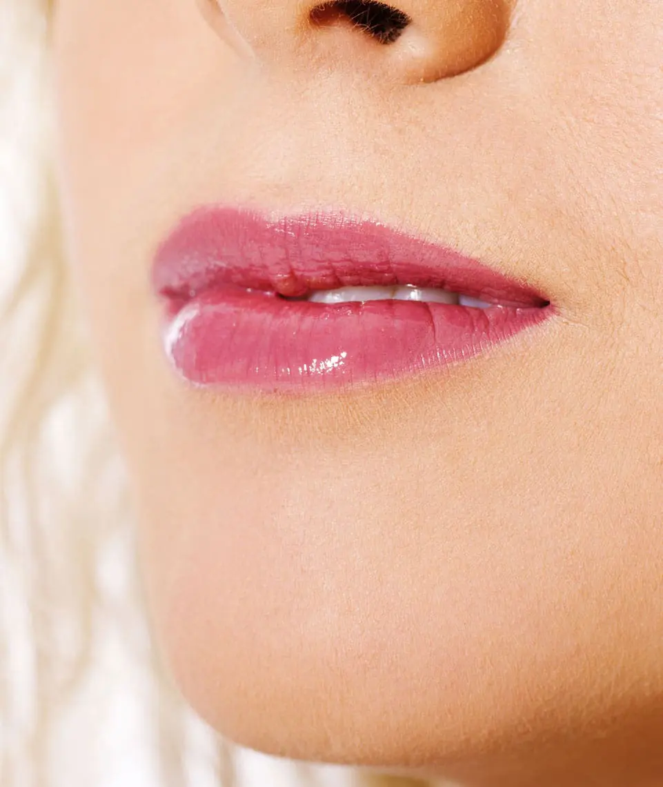 dr-grace-kelly-your-conditions-face-thin-lips