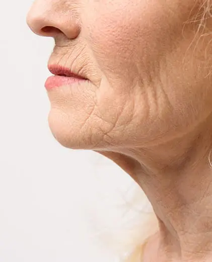 dr-grace-kelly-your-conditions-face-wrinkles-featured