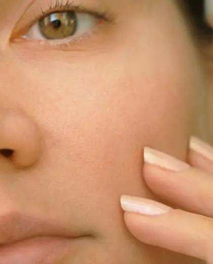 dr-grace-kelly-your-conditions-skin-large-pores-featured