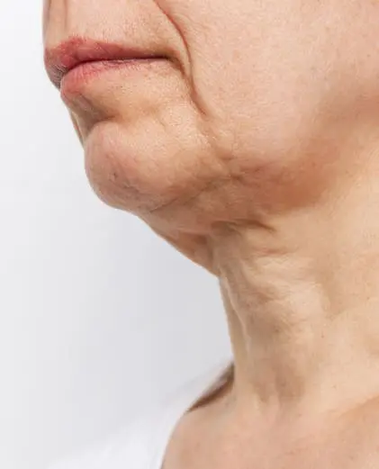 dr-grace-kelly-your-conditions-skin-sagging-skin-featured