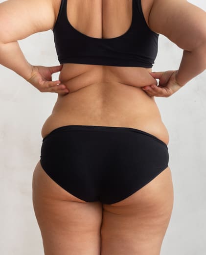 bikini back fat
