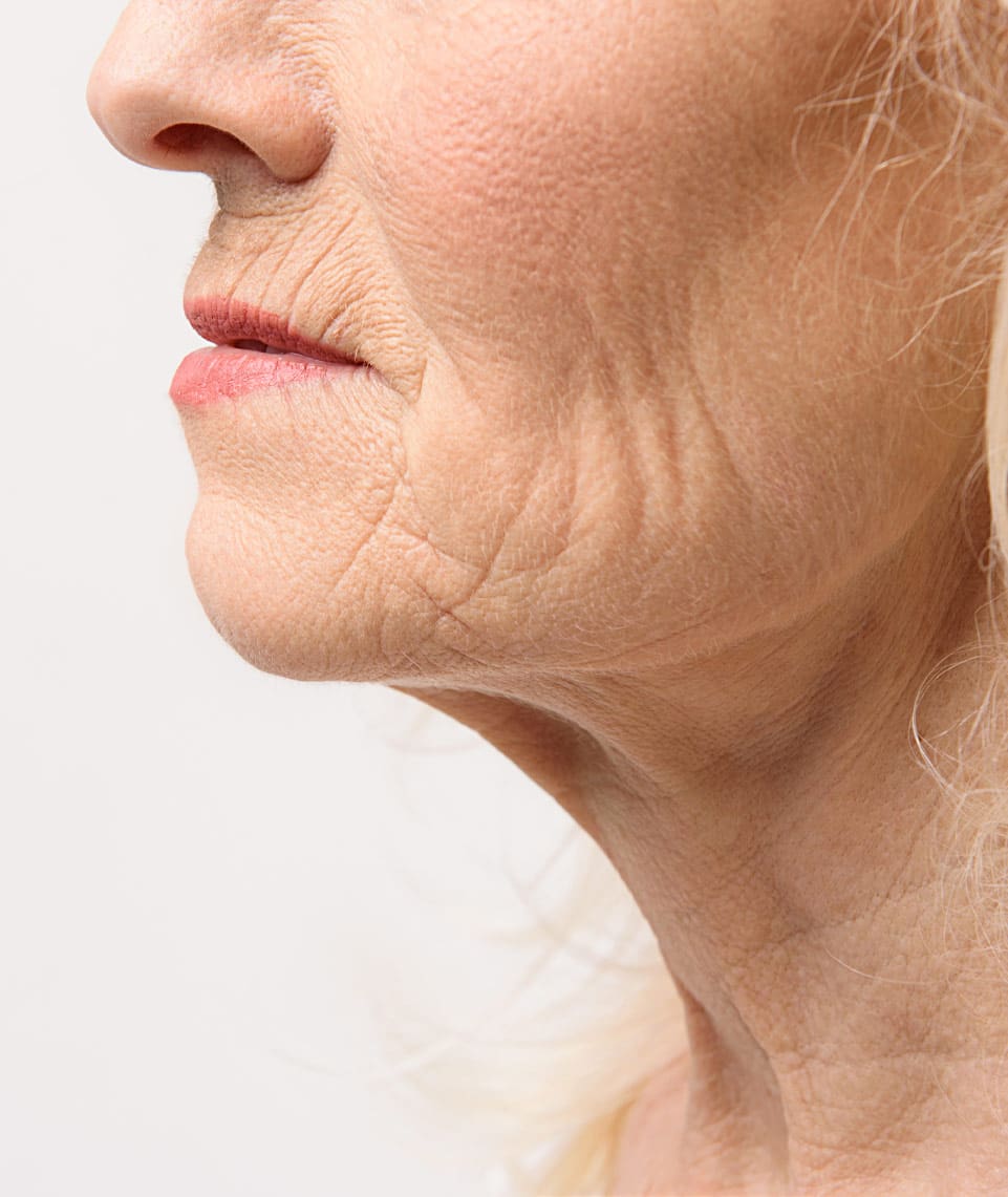 dr-grace-kelly-your-conditions-face-wrinkles