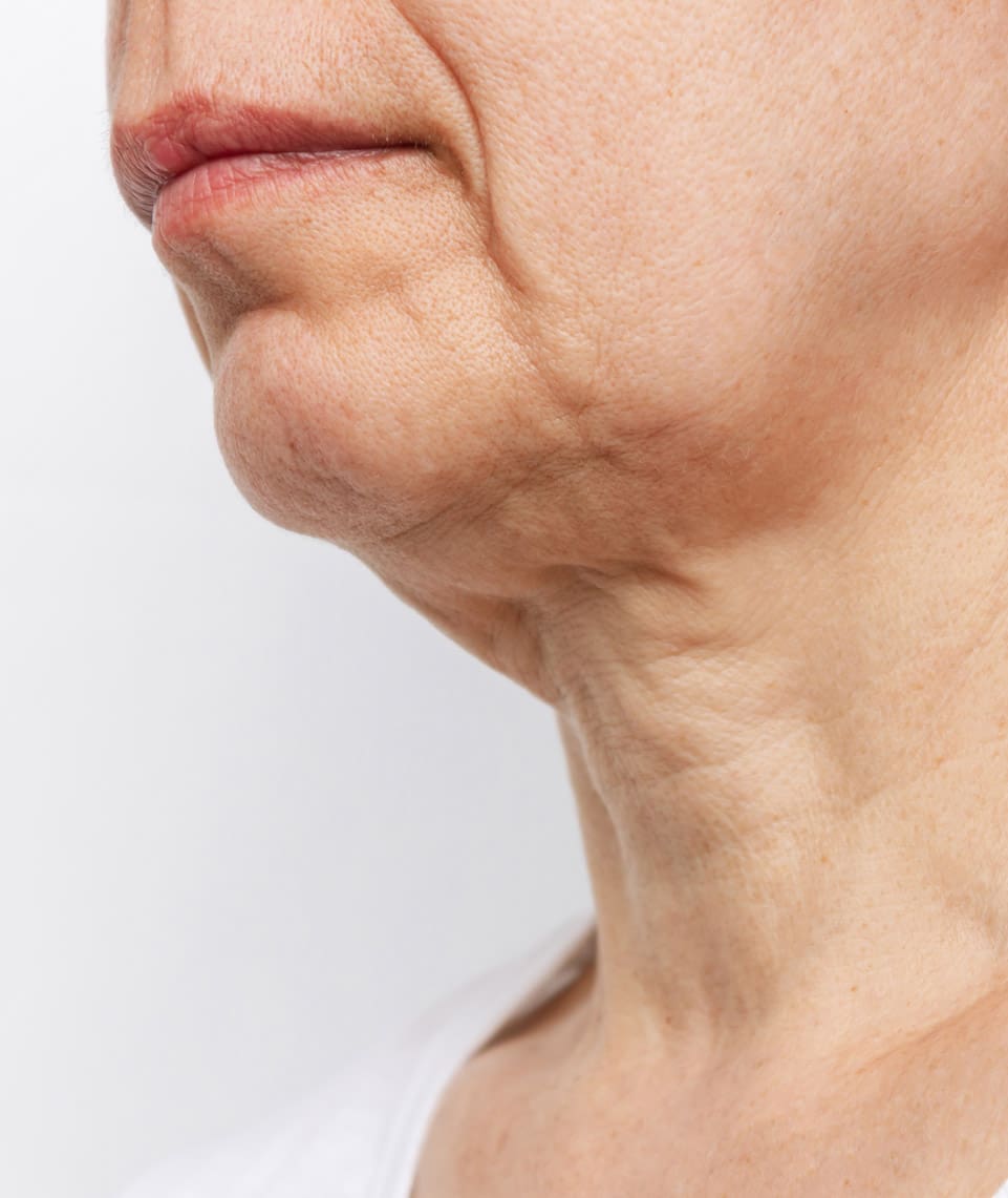 The Top 5 Non Surgical Treatments for Neck Rejuvenation